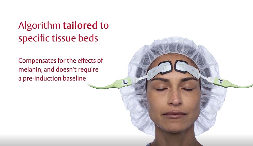 ForeSight Elite tissue oximetry system overview video